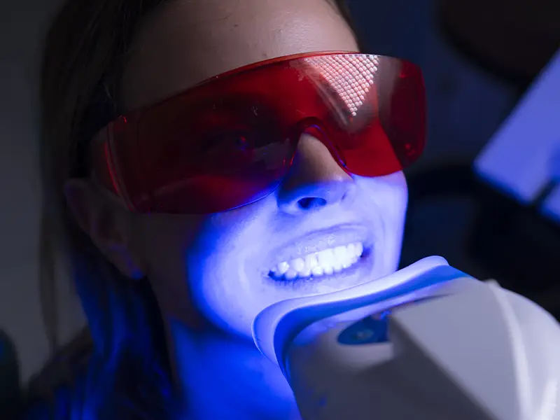 Baragazza - Sbiancamento professionale