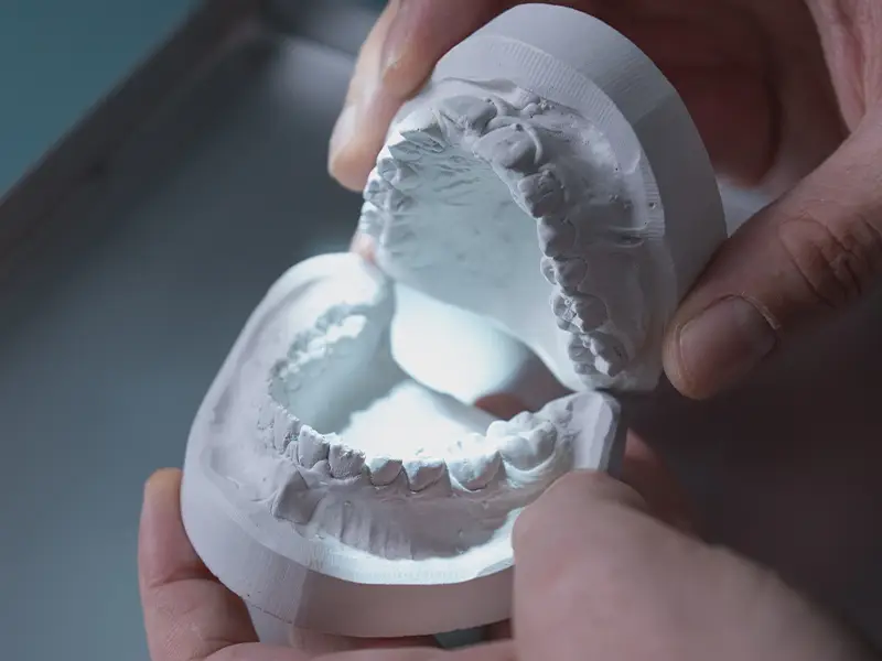 Baragazza - Impianti dentali