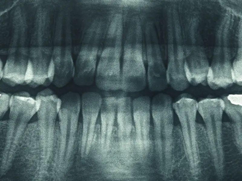 Baragazza - Tecnologie